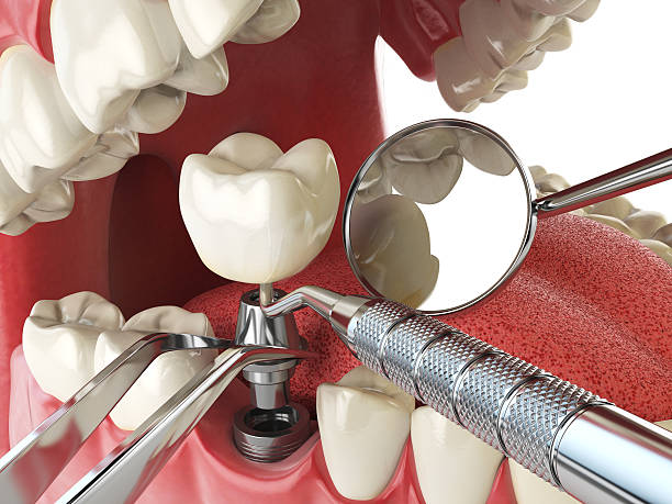 Best Emergency Cosmetic Dentistry (e.g., broken veneers) in Loveland Park, OH